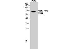 Western Blot analysis of A549 cells using Acetyl-Nrf2 (K599) Polyclonal Antibody. (NRF2 anticorps  (acLys599))