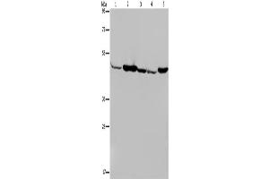 Western Blotting (WB) image for anti-Isocitrate Dehydrogenase 2 (NADP+), Mitochondrial (IDH2) antibody (ABIN2423636) (IDH2 anticorps)