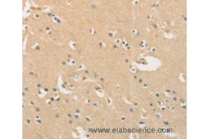 Immunohistochemistry of Human brain  using CHRNA2 Polyclonal Antibody at dilution of 1:40 (CHRNA2 anticorps)