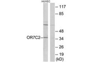 Western Blotting (WB) image for anti-Olfactory Receptor, Family 7, Subfamily C, Member 2 (OR7C2) (AA 198-247) antibody (ABIN2891049) (OR7C2 anticorps  (AA 198-247))