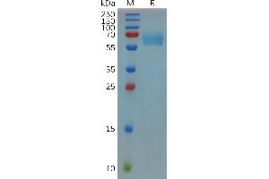 Mouse CD27 Protein, hFc Tag on SDS-PAGE under reducing condition. (CD27 Protein (AA 24-182) (Fc Tag))