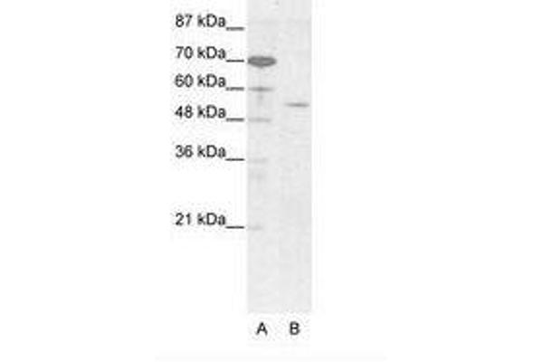 EVX2 anticorps  (AA 63-112)