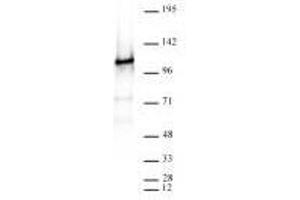 CTCF antibody (rAb) tested by Western blot. (Recombinant CTCF anticorps)