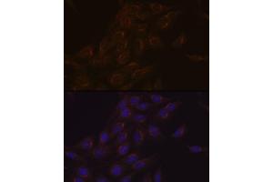 Immunofluorescence analysis of C6 cells using PIST/GOPC Rabbit mAb (ABIN1678809, ABIN1678808, ABIN7101325 and ABIN7101326) at dilution of 1:100 (40x lens). (GOPC anticorps)
