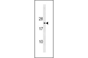 Mouse p27Kip1 Antibody (C-term ) (ABIN1881618 and ABIN2843237) western blot analysis in mouse heart tissue lysates (35 μg/lane). (CDKN1B anticorps  (C-Term))
