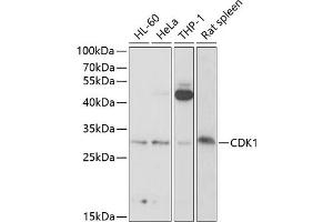 Western blot analysis of extracts of various cell lines, using CDK1 antibody (ABIN6134274, ABIN6138303, ABIN6138304 and ABIN6219543) at 1:1000 dilution. (CDK1 anticorps  (AA 208-258))