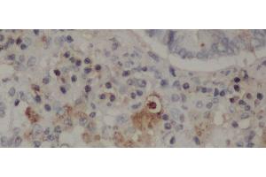 Immunohistochemistry of paraffin-embedded Rat lung using CD68 Polyclonal Antibody at dilution of 1:50 (CD68 anticorps)