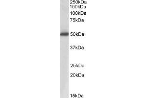 Western Blotting (WB) image for anti-Acid Phosphatase, Prostate (ACPP) antibody (ABIN5855941) (ACPP anticorps)