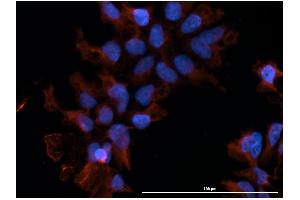 Immunofluorescence  staining of huSSECTM cell line overexpressing hFcRn-EGFP using  clone DVN24 at 15µg/ml and Texas Red™ conjugated anti-mouse secondary. (FcRn anticorps)