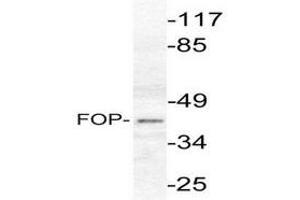 Image no. 1 for anti-FGFR1 Oncogene Partner (FGFR1OP) antibody (ABIN265416) (FGFR1OP anticorps)