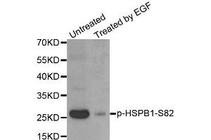 Western Blotting (WB) image for anti-Heat Shock 27kDa Protein 1 (HSPB1) (pSer82) antibody (ABIN1870246) (HSP27 anticorps  (pSer82))
