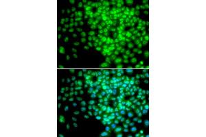 Immunofluorescence analysis of HeLa cells using POLR2F antibody. (POLR2F anticorps)
