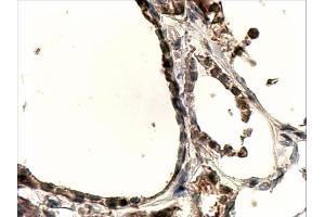 ABIN263200 (4µg/ml) staining of paraffin embedded Human Thyroid Gland. (DUOX1 anticorps  (Internal Region))