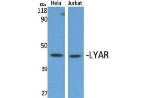 Western Blotting (WB) image for anti-Ly1 Antibody Reactive (LYAR) (Internal Region) antibody (ABIN6282236) (LYAR anticorps  (Internal Region))