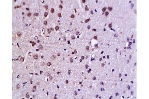 Immunohistochemistry (Paraffin-embedded Sections) (IHC (p)) image for anti-Jun Proto-Oncogene (JUN) (AA 31-331) antibody (ABIN671691)