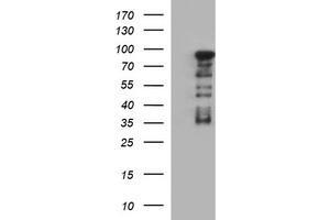 Image no. 1 for anti-Forkhead Box P1 (FOXP1) antibody (ABIN1498299) (FOXP1 anticorps)