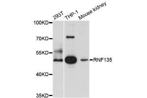 Western blot analysis of extracts of various cell lines, using RNF135 antibody (ABIN5996007) at 1/1000 dilution. (RNF135 anticorps)