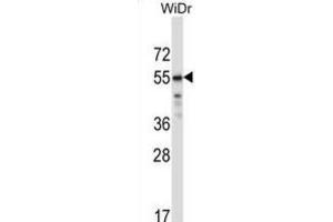 Western Blotting (WB) image for anti-Transcription Factor CP2-Like 1 (TFCP2L1) antibody (ABIN2997307) (TFCP2L1 anticorps)