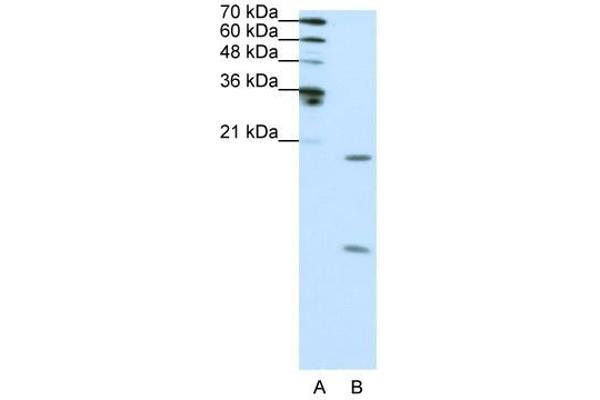 SNRPF anticorps  (N-Term)