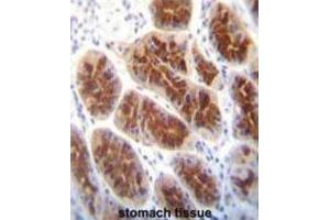 Immunohistochemistry (IHC) image for anti-Claudin 2 (CLDN2) antibody (ABIN2996861) (Claudin 2 anticorps)