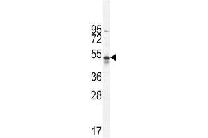 Western Blotting (WB) image for anti-TNFR-S274 antibody (ABIN2996049) (TNFR-S274 anticorps)