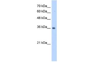 TRUB2 antibody used at 1 ug/ml to detect target protein. (TRUB2 anticorps  (N-Term))