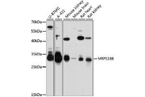 Western blot analysis of extracts of various cell lines, using MRPS18B antibody (ABIN6293873) at 1:3000 dilution. (MRPS18B anticorps)