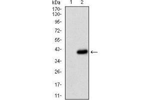 Western blot analysis using CD36 mAb against HEK293 (1) and CD36 (AA: 30-130)-hIgGFc transfected HEK293 (2) cell lysate. (CD36 anticorps  (AA 30-130))