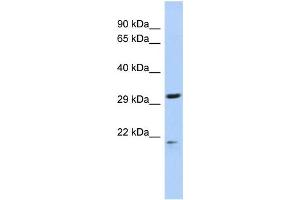 Western Blotting (WB) image for anti-Chromosome 14 Open Reading Frame 80 (C14ORF80) antibody (ABIN2459946) (C14ORF80 anticorps)