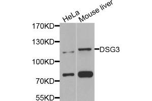Western blot analysis of extracts of various cell lines, using DSG3 antibody (ABIN5974847) at 1/1000 dilution. (Desmoglein 3 anticorps)