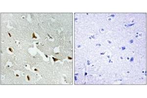 Immunohistochemistry analysis of paraffin-embedded human brain tissue, using IRS-1 (Ab-636) Antibody. (IRS1 anticorps  (AA 603-652))