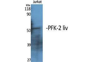 Western Blot (WB) analysis of specific cells using PFK-2 liv Polyclonal Antibody. (PFK-2 LIV (C-Term) anticorps)