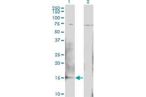 Western Blot analysis of BTG2 expression in transfected 293T cell line by BTG2 monoclonal antibody (M02), clone 1B8. (BTG2 anticorps  (AA 59-158))