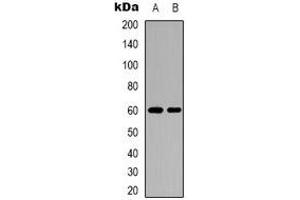 Western blot analysis of Importin alpha 2 expression in mouse heart (A), mouse brain (B) whole cell lysates. (KPNA2 anticorps  (N-Term))