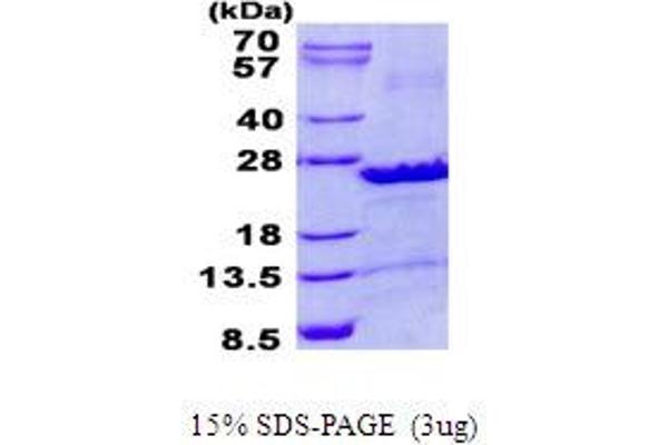 SEC22B Protein (His tag)