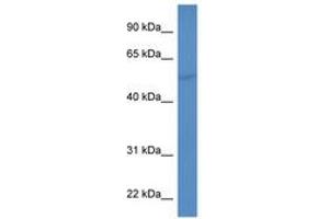 Image no. 1 for anti-Cytochrome P450, Family 2, Subfamily A, Polypeptide 6 (CYP2A6) (C-Term) antibody (ABIN6746762) (CYP2A6 anticorps  (C-Term))