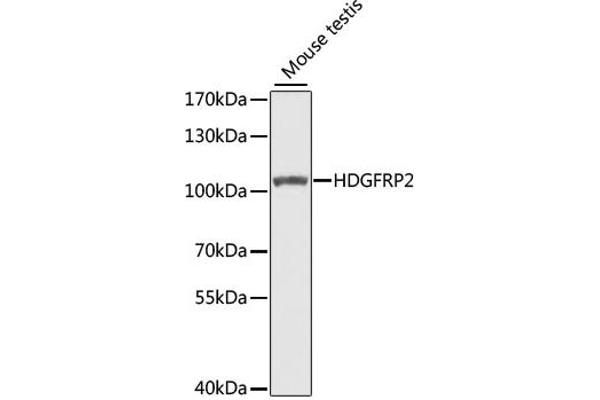 HDGFRP2 anticorps  (AA 501-670)