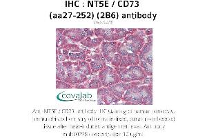 Image no. 2 for anti-5'-Nucleotidase, Ecto (CD73) (NT5E) (AA 27-252) antibody (ABIN1723204) (CD73 anticorps  (AA 27-252))