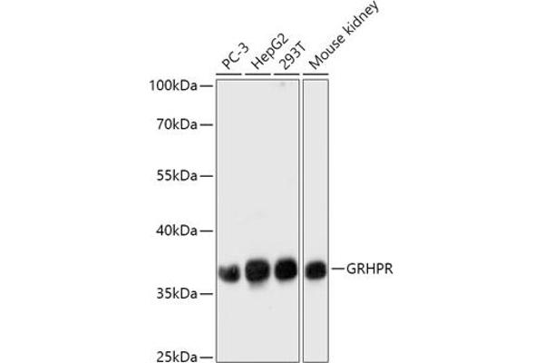 GRHPR anticorps  (AA 100-328)