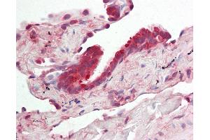 Human Lung: Formalin-Fixed, Paraffin-Embedded (FFPE). (RNH1 anticorps  (AA 251-300))