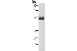 Western Blotting (WB) image for anti-1-Acylglycerol-3-Phosphate O-Acyltransferase 6 (Lysophosphatidic Acid Acyltransferase, Zeta) (AGPAT6) antibody (ABIN2427468) (AGPAT6 anticorps)