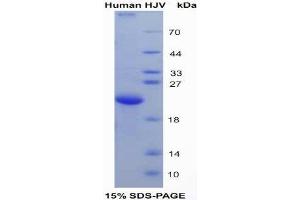 SDS-PAGE (SDS) image for Hemochromatosis Type 2 (Juvenile) (HFE2) (AA 234-416) protein (His tag) (ABIN1079847) (HFE2 Protein (AA 234-416) (His tag))