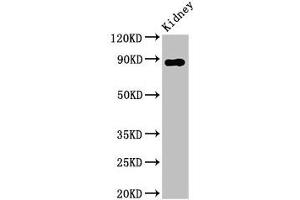 Western Blot Positive WB detected in: Rat kidney tissue All lanes: DPP4 antibody at 2. (DPP4 anticorps  (AA 473-588))