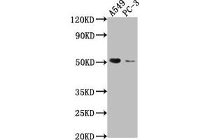 Western Blot Positive WB detected in: A549 whole cell lysate, PC-3 whole cell lysate All lanes: TNFRSF1A antibody at 1:2000 Secondary Goat polyclonal to rabbit IgG at 1/50000 dilution Predicted band size: 51, 39, 26, 25 kDa Observed band size: 51 kDa (TNFRSF1A anticorps  (AA 249-455))