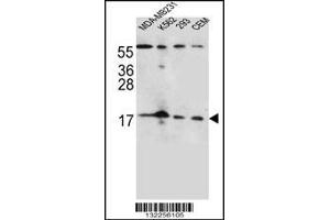 Western blot analysis in MDA-MB231,K562,293,CEM cell line lysates (35ug/lane). (FGF22 anticorps  (N-Term))