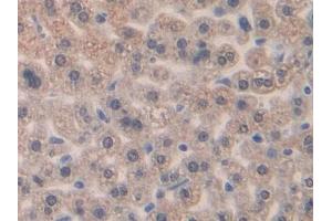 DAB staining on IHC-P; Samples: Mouse Liver Tissue (CCL4 anticorps  (AA 24-92))