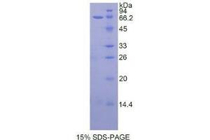 SDS-PAGE (SDS) image for Telomerase Reverse Transcriptase (TERT) (AA 787-1084) protein (His tag,GST tag) (ABIN1877400) (TERT Protein (AA 787-1084) (His tag,GST tag))