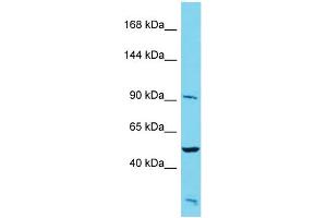 Host: Rabbit Target Name: PALD1 Sample Type: HepG2 Whole Cell lysates Antibody Dilution: 1. (KIAA1274 anticorps  (N-Term))