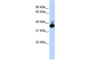 Western Blotting (WB) image for anti-Aldolase B, Fructose-Bisphosphate (ALDOB) antibody (ABIN2458580) (ALDOB anticorps)