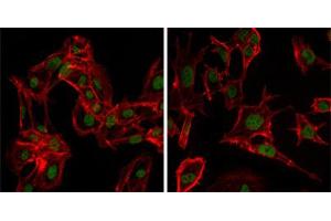 Immunofluorescence analysis of MSCs(left) and NTERA-2 (right) cells using DDX4 mouse mAb (green). (DDX4 anticorps)